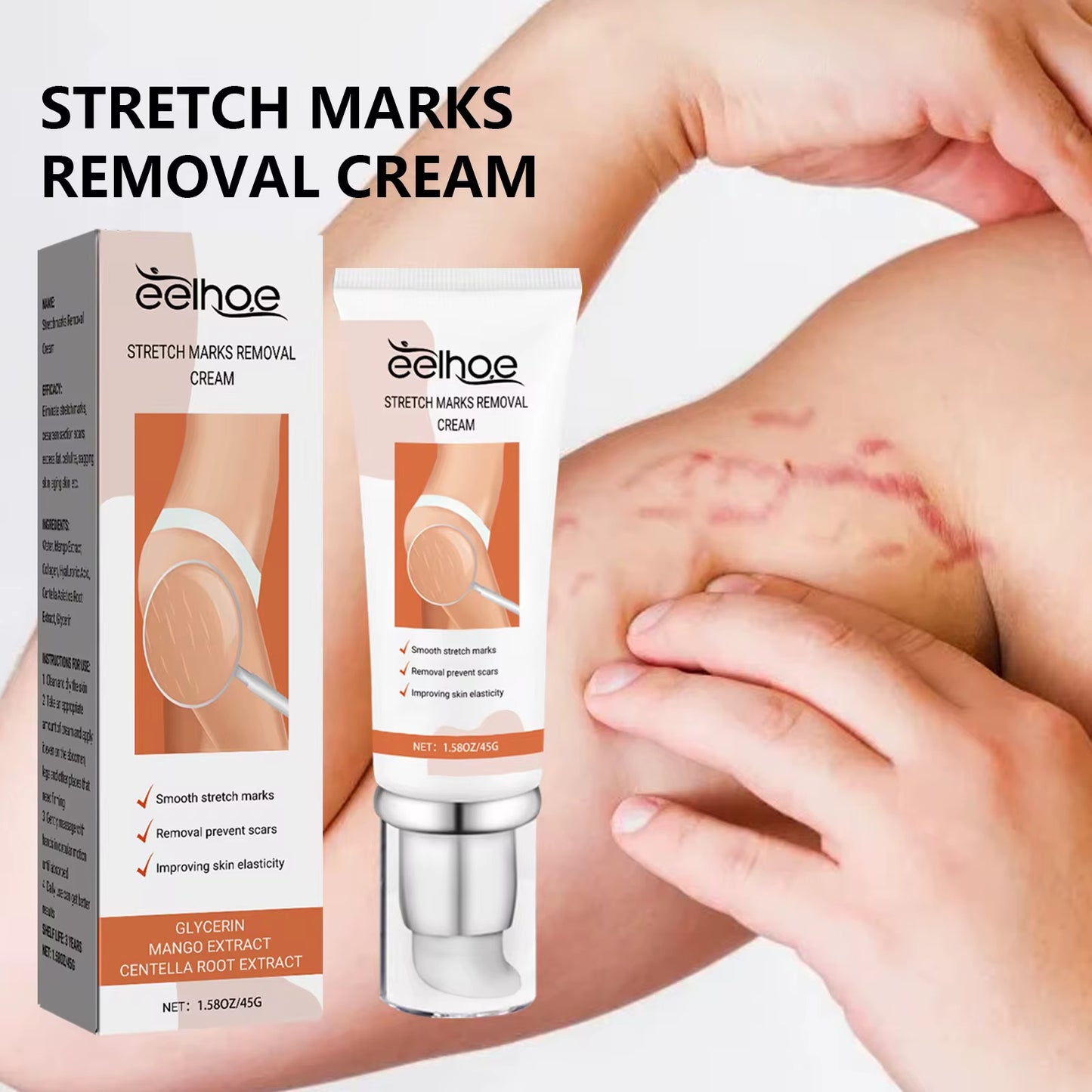 OEM ODM Crème réparatrice organique naturelle pour les vergetures la meilleure crème d'élimination des vergetures Soins de santé