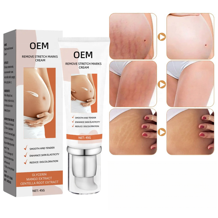 OEM ODM Crème réparatrice organique naturelle pour les vergetures la meilleure crème d'élimination des vergetures Soins de santé